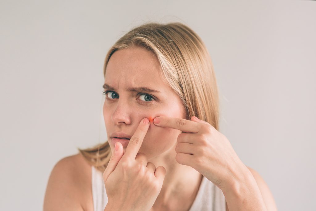 woman popping a pimple